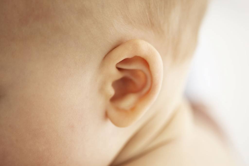 Novo tratamento corrige orelhas de abano sem necessidade de cirurgia