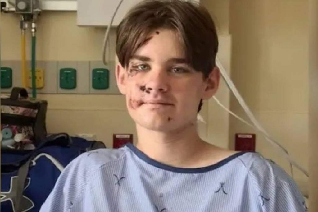 Garoto de 14 anos sobrevive após cair da borda do Grand Canyon