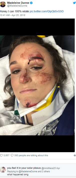 Shelby Pagan: foto de acidente e delineador viralizou nas redes sociais