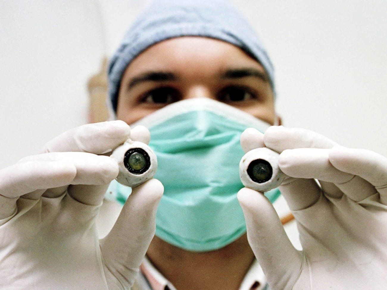 El primer trasplante de córnea artificial del mundo revisita al ciego